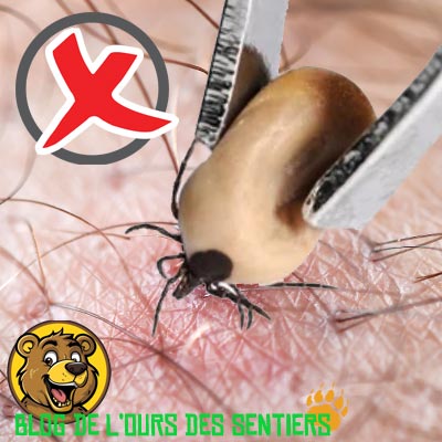 Surtout ne pas appuyer sur le corps d'une tique lorsque vous la décrochez afin de ne pas la faire régurgiter des germes dangereux de la borreliose dans le sang