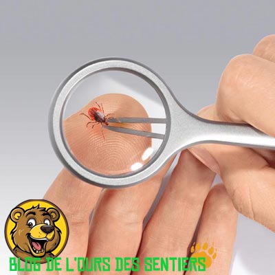 Une pince à épiler couplée à une petite loupe vous permet de grossir la zone d'action et de mieux cibler la tête de la tique pour la décrocher de façon optimale